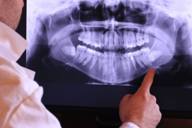 Best Broken or Chipped Tooth Repair in Orting, WA